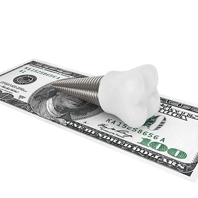 dental implant and money for cost of dental implants in Rockwall  