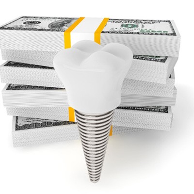 Implant and money representing the cost of dental implants in Rockwall 