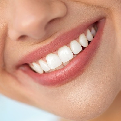 Closeup of healthy smile after scaling and root planing