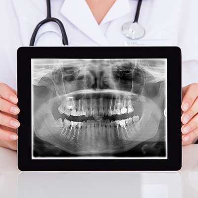 Digital dental x-rays on tablet computer